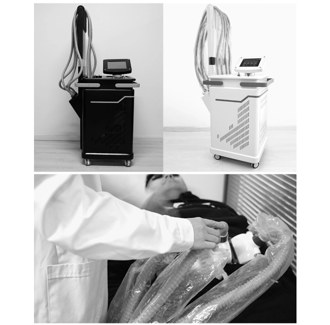 Laser 1060 za oblikovanje tijela